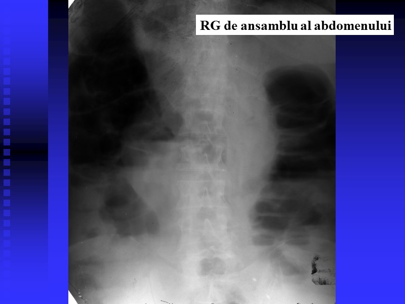 RG de ansamblu al abdomenului